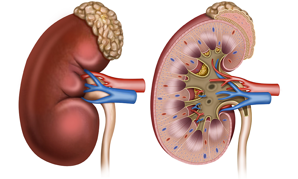 THE SURGICAL TREATMENT OF RENAL TUMORS - A 30-MONTH EVALUATION OF THE POST OPERATIVE PERIOD AT A SECONDARY CENTER