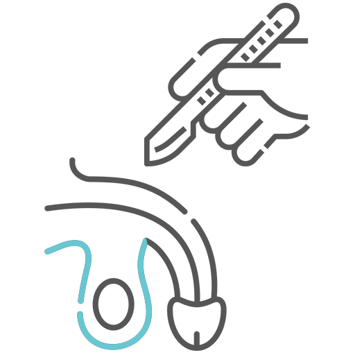 SPERM COLLECTION + POSSIBLE SAMPLING FROM THE TESTIS (MICROSURGICAL)