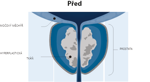 Před operaci