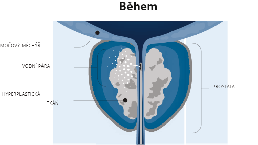 Během operaci